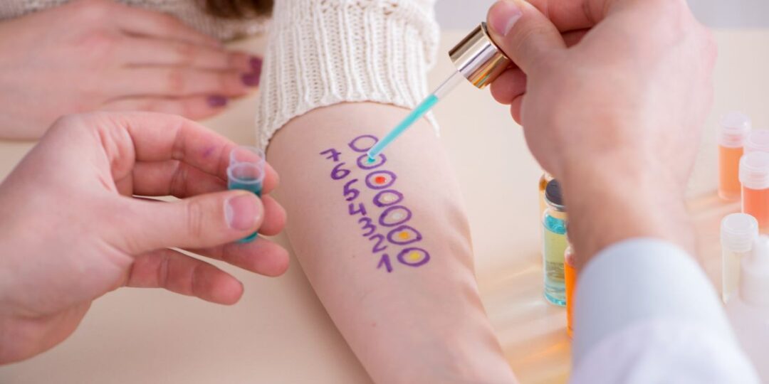 How and Why Metals like Gold and Silver Can be Allergic to Skin