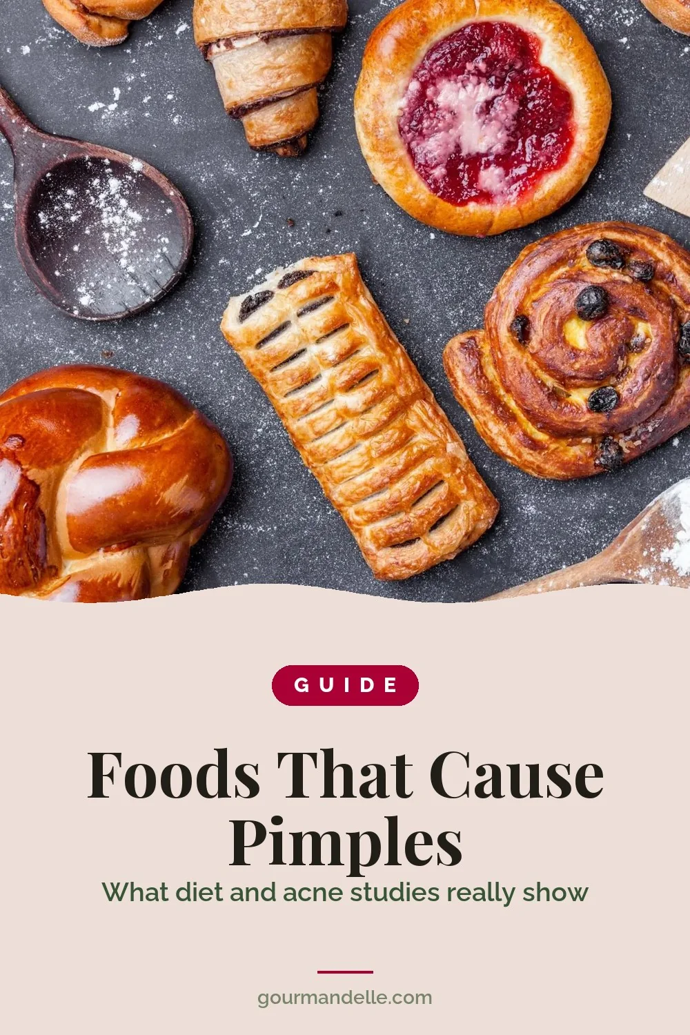 Guide cover for Foods That Cause Pimples, with white flour pastries, croissants, a jam danish and a brioche on a dark floured surface.